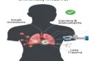Groundbreaking “First” – Porunai Hospitals Pioneers South Tamil Nadu’s First Video-Assisted Thoracoscopic Surgery (VATS) Lobectomy